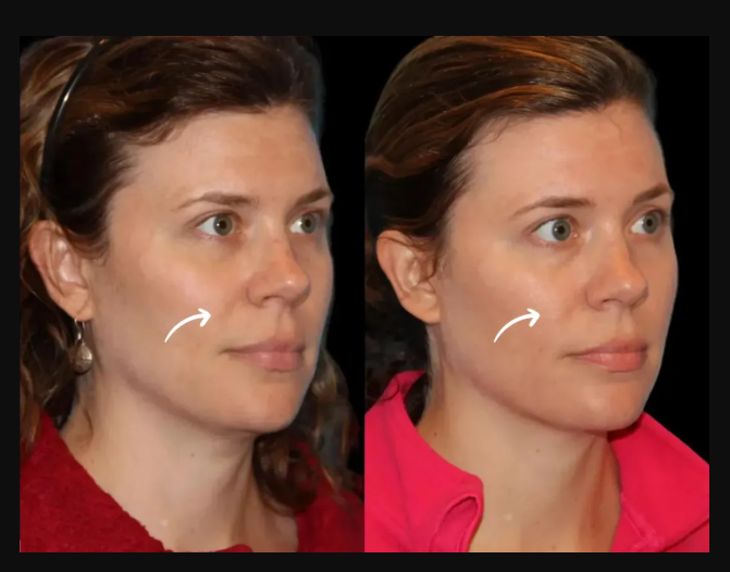 Best Plastic Surgeon in dubai